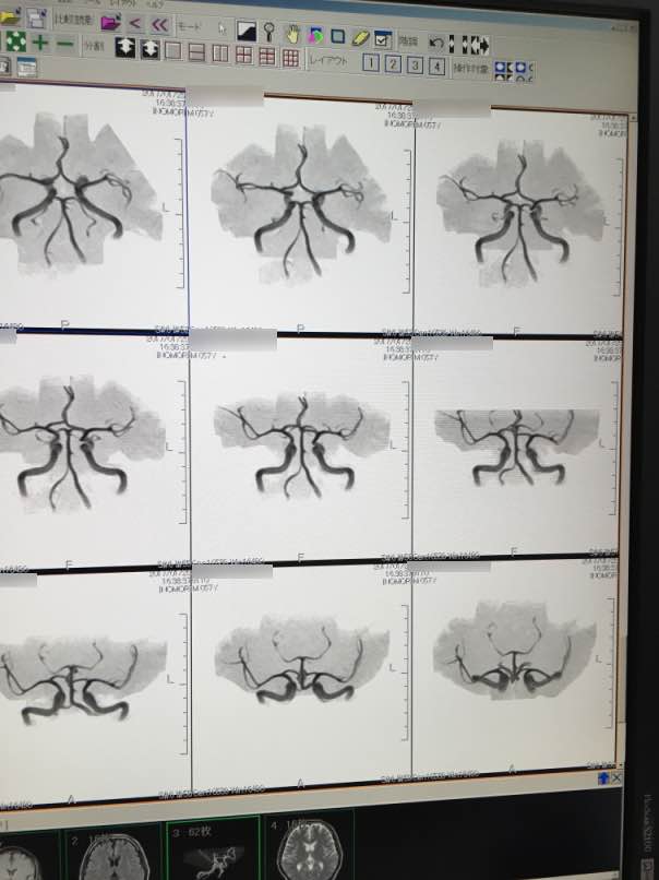 mri2017002.jpg